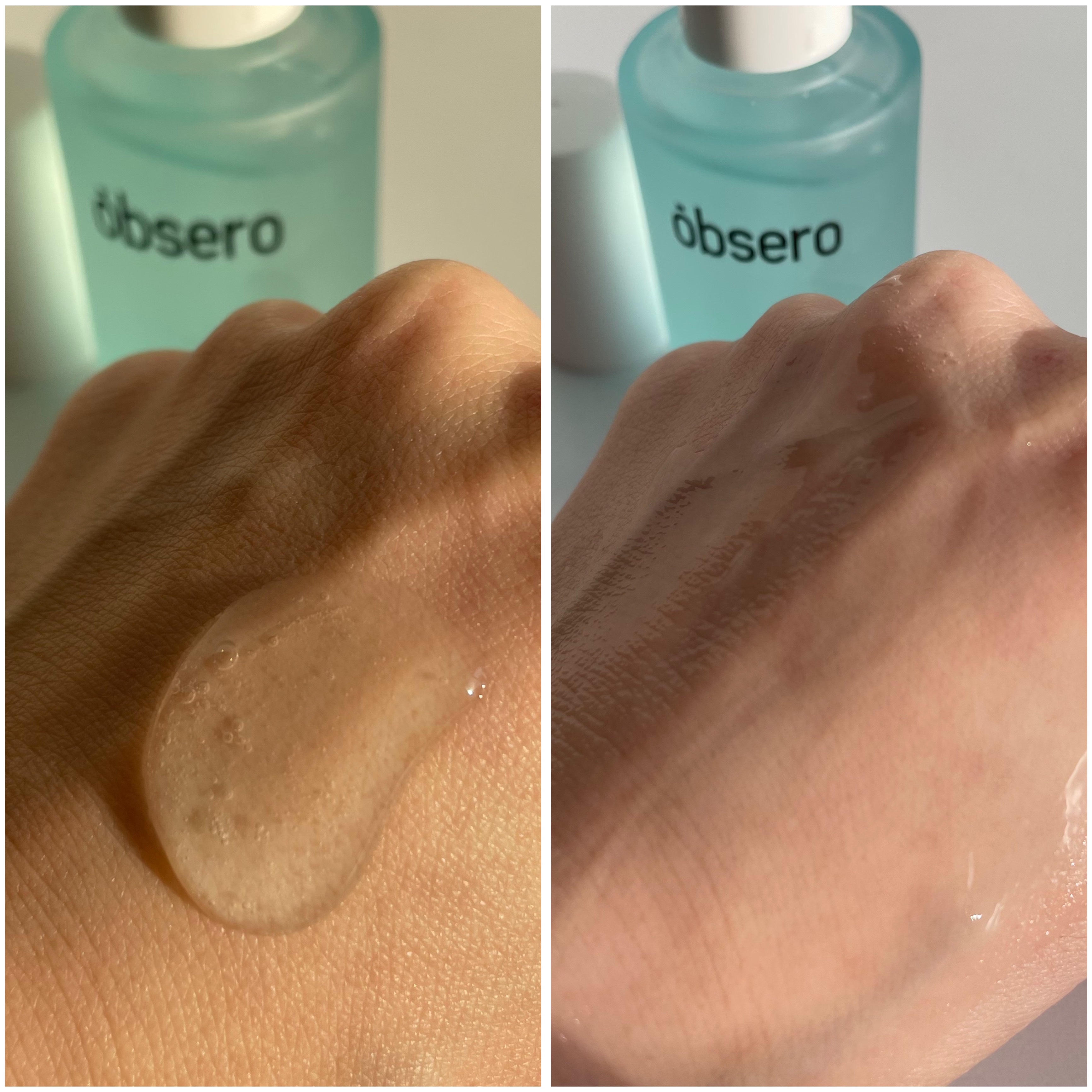 グリーンカーミングブルーレーションクリーンアンプル/obsero/美容液を使ったクチコミ（3枚目）