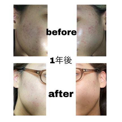 洗顔フォーム/セラアクア/洗顔フォームを使ったクチコミ(2枚目)