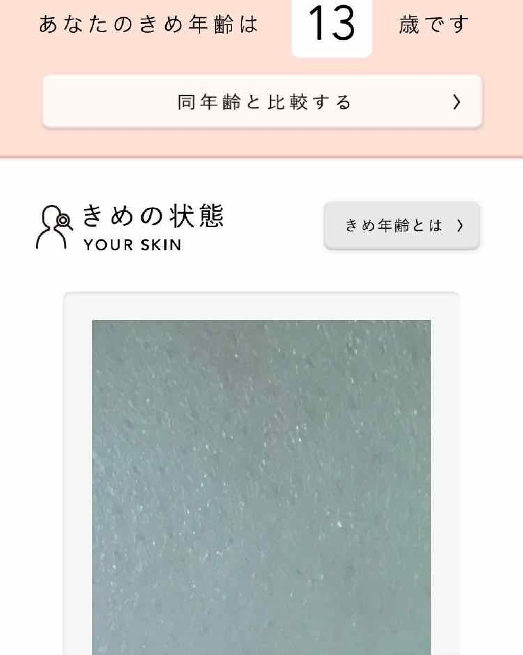 ハトムギ化粧水(ナチュリエ スキンコンディショナー R )/ナチュリエ/化粧水を使ったクチコミ(2枚目)