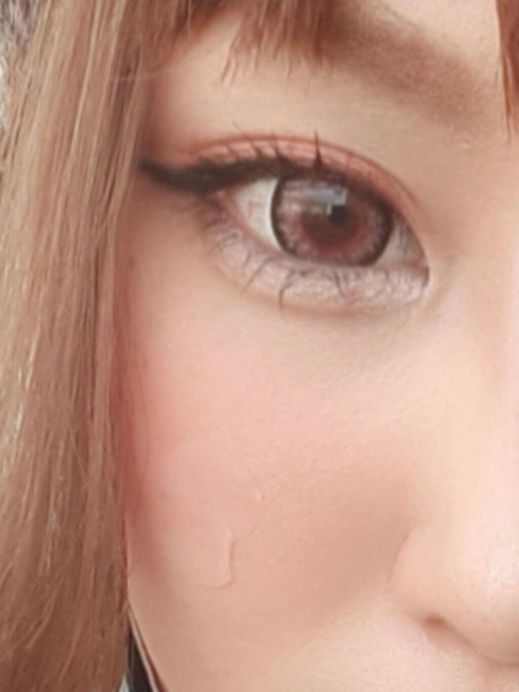 薄型ハイドロコロイドポイントシール/キャンドゥ/その他を使ったクチコミ（2枚目）