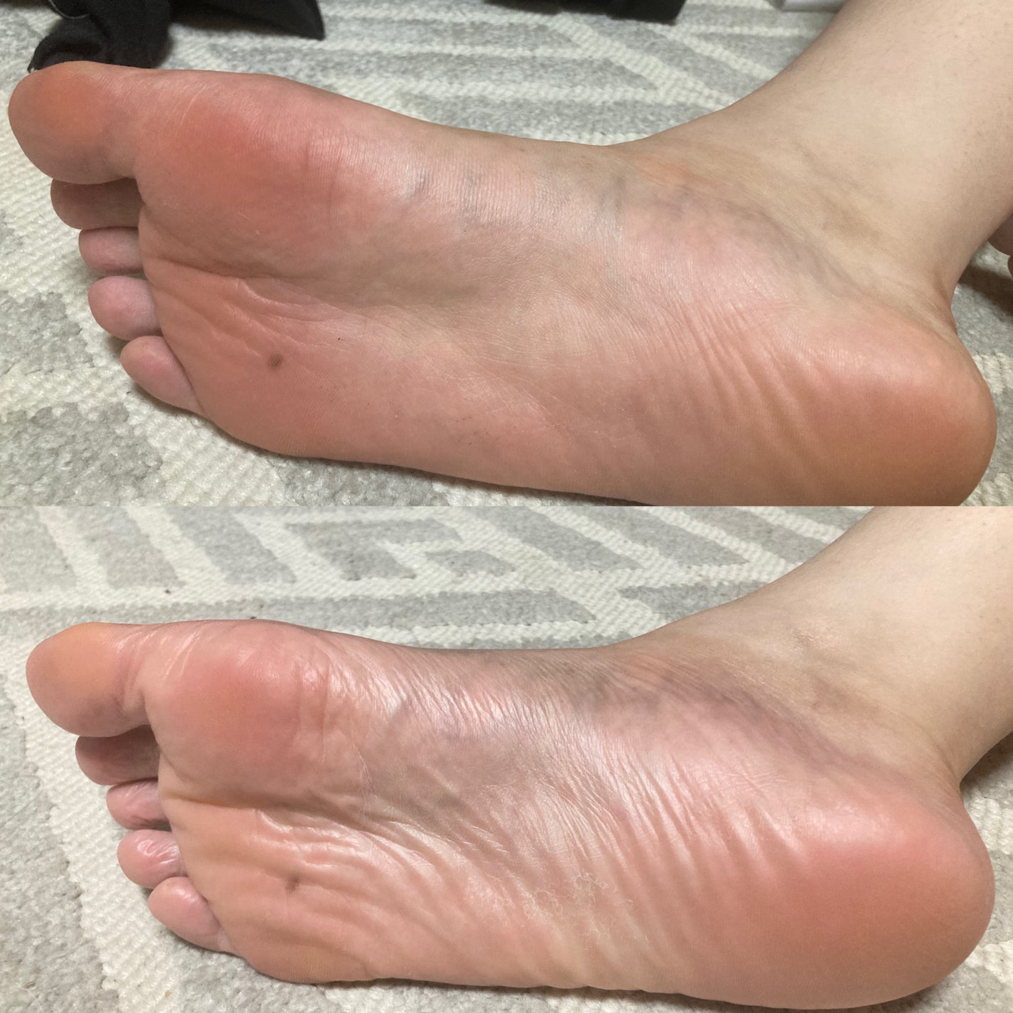 イージーパックDP60分タイプ/ベビーフット/レッグ・フットケアを使ったクチコミ(7枚目)
