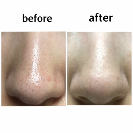 ソフティモ スピーディ クレンジングオイル/ソフティモ/オイルクレンジングを使ったクチコミ(2枚目)