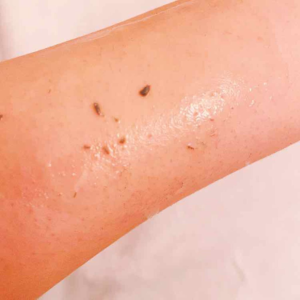 JUSO KURO PEELING（重曹配合ピーリングジェル）/NAKUNA-RE/ピーリングを使ったクチコミ（2枚目）