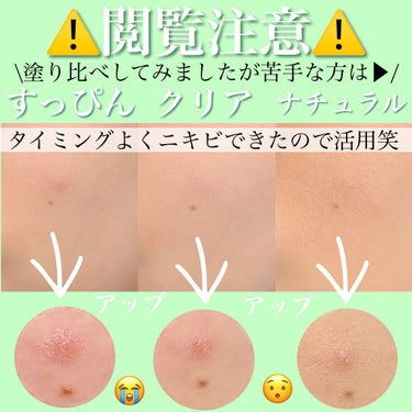 アクメディカ 薬用 フェイスパウダー ナチュラル/ナリスアップ/パウダーファンデーションを使ったクチコミ（6枚目）