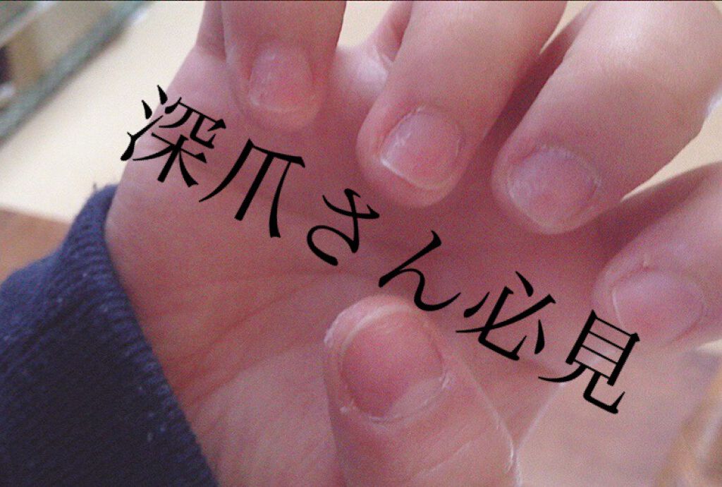 あさみん on LIPS 「こんにちは☀︎深爪、ペラペラ爪に悩む方の力になれたらと思ったの..」(1枚目)