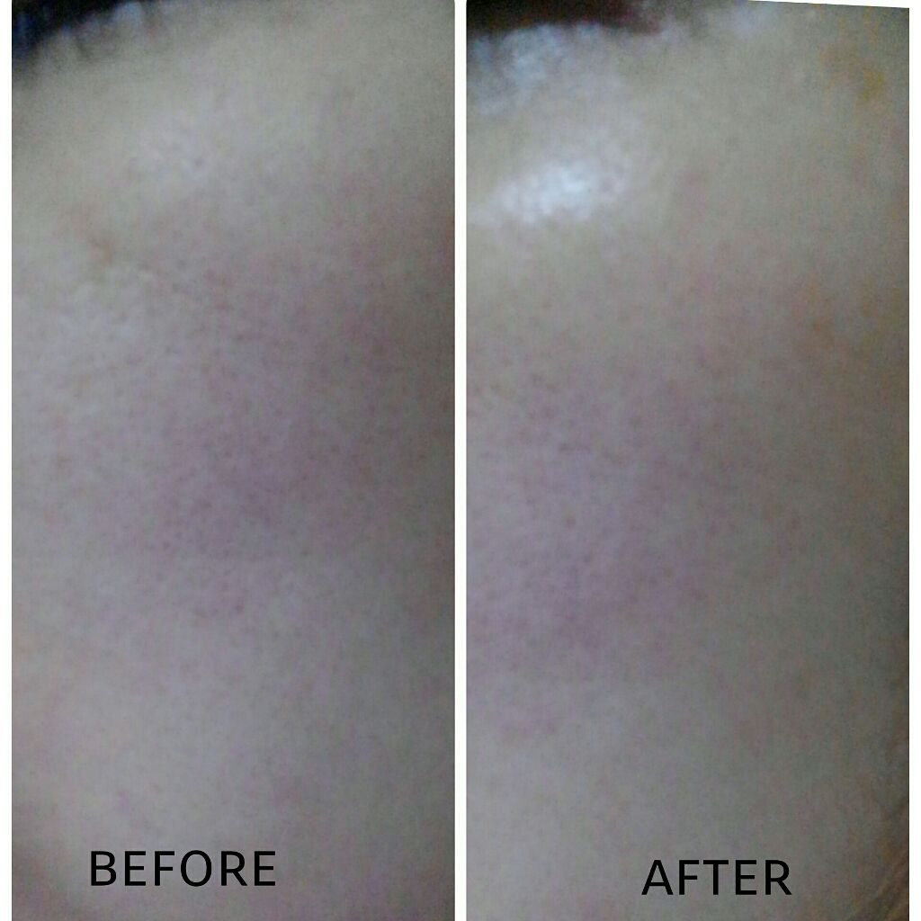 ボタニカル高保湿ジェル/NICE ＆ QUICK/美容液を使ったクチコミ（3枚目）