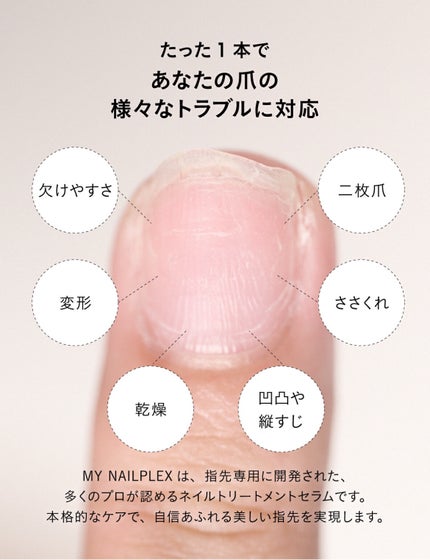MY NAILPLEX/TITANAIL/オールインワンネイルを使ったクチコミ(5枚目)