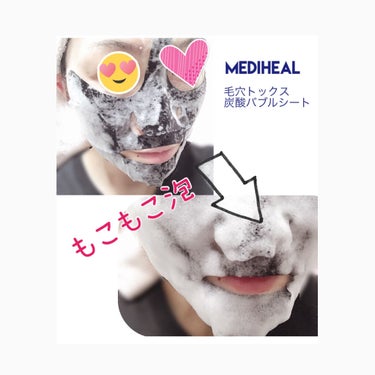 炭酸バブルシート/MEDIHEAL/シートマスク・パックを使ったクチコミ（3枚目）