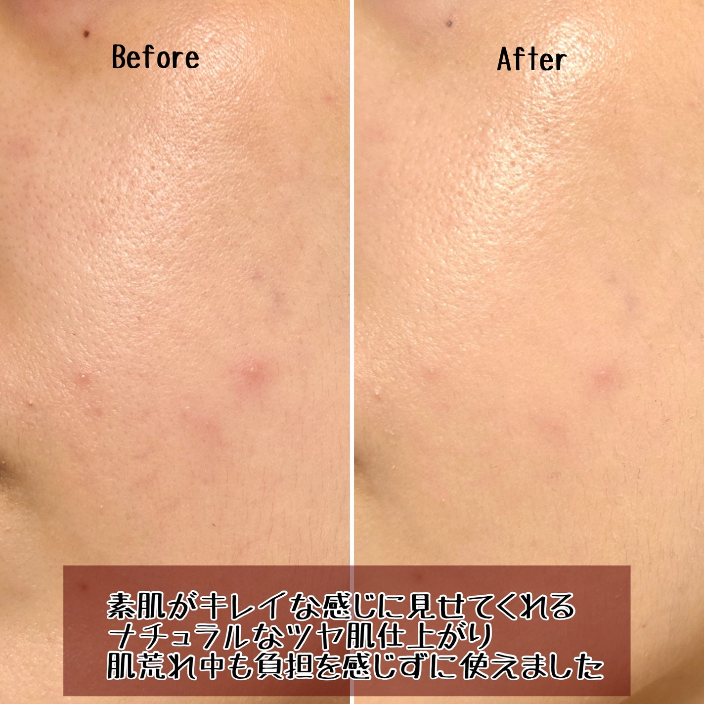 薬用クリアエステヴェール/Macchia Label/リキッドファンデーションを使ったクチコミ(3枚目)