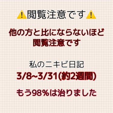 無印良品 敏感肌用薬用美白美容液のクチコミ「お久しぶりです〜

最初の投稿から約3ヶ月！！
肌のケアも毎日欠かさずやっていたら三日坊主の私.....」（1枚目）