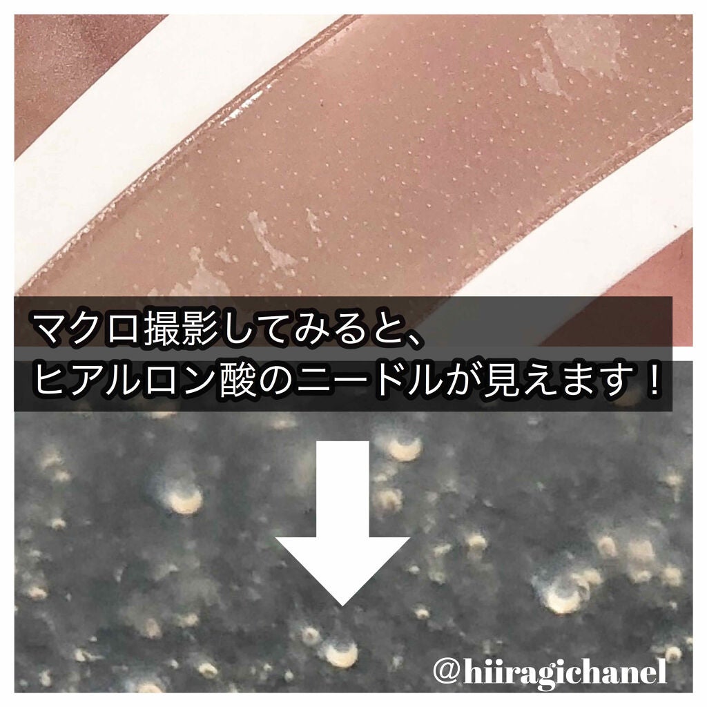 メディリフト 3Dマイクロフィラー(口元用)/YA-MAN TOKYO JAPAN/シートマスク・パックを使ったクチコミ(4枚目)