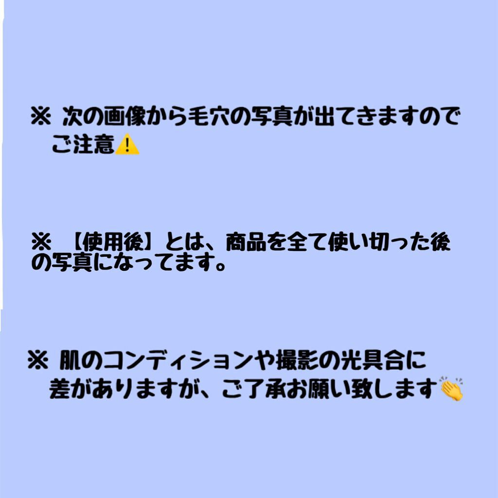 ルルルン クレンジングバーム(アロマタイプ)/ルルルン/クレンジングバームを使ったクチコミ(2枚目)