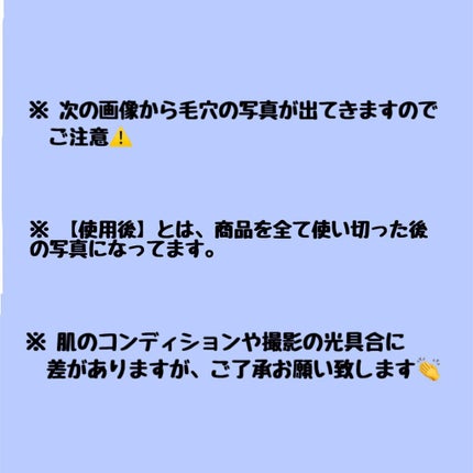 デュオ ザ クレンジングバーム ブラック/DUO/クレンジングバームを使ったクチコミ(2枚目)