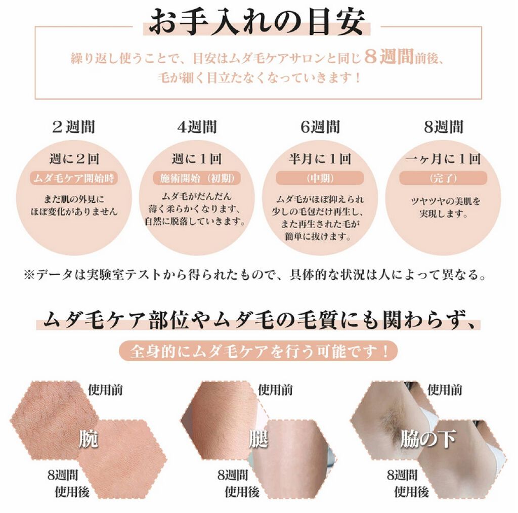 光脱毛器 VIO/Sarlisi/家庭用脱毛器を使ったクチコミ（3枚目）