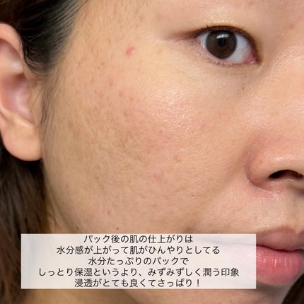 ウォーターマイド エッセンシャルマスク/MEDIHEAL/シートマスク・パックを使ったクチコミ(7枚目)