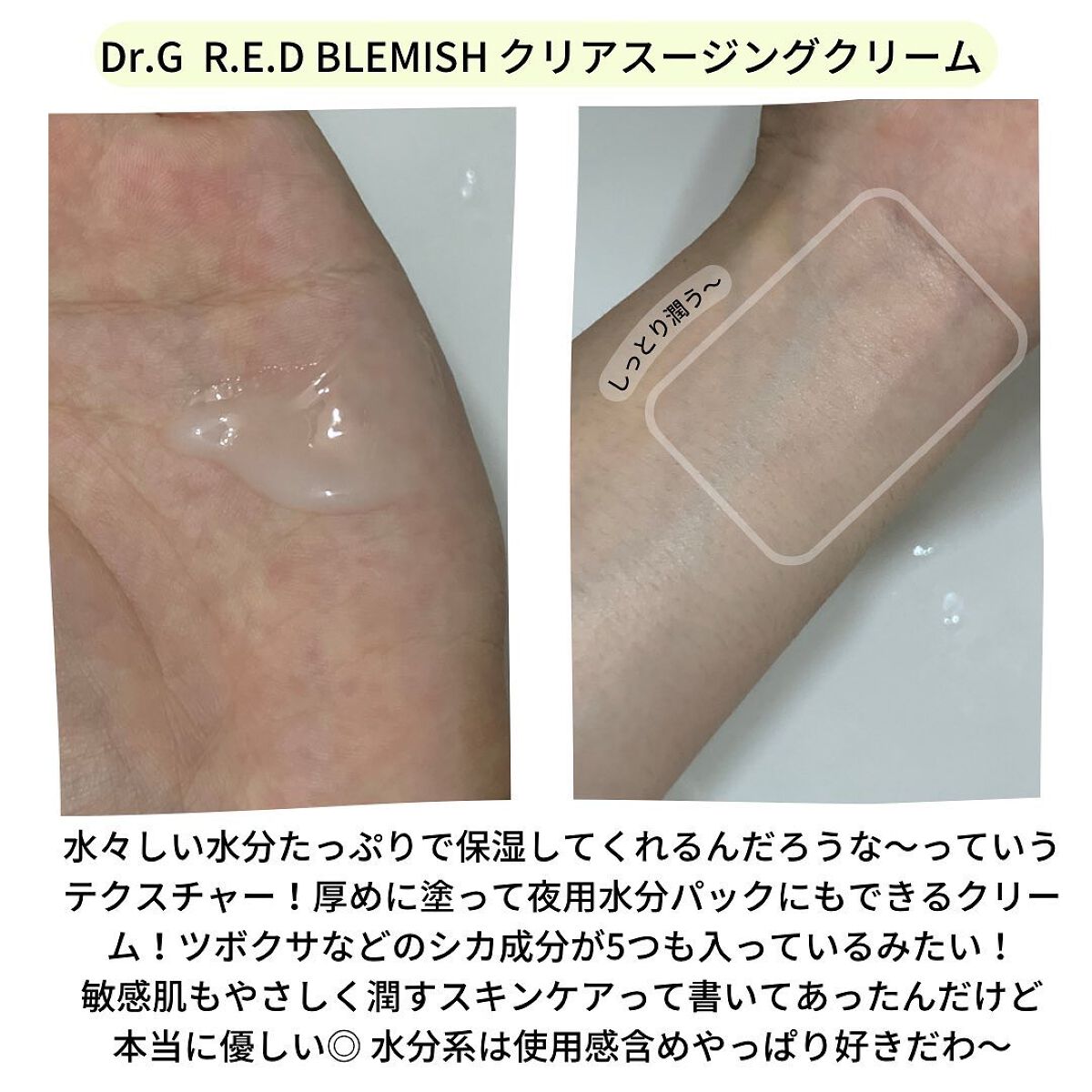 レッドB・Cスムージングクリーム/Dr.G/フェイスクリームを使ったクチコミ（3枚目）