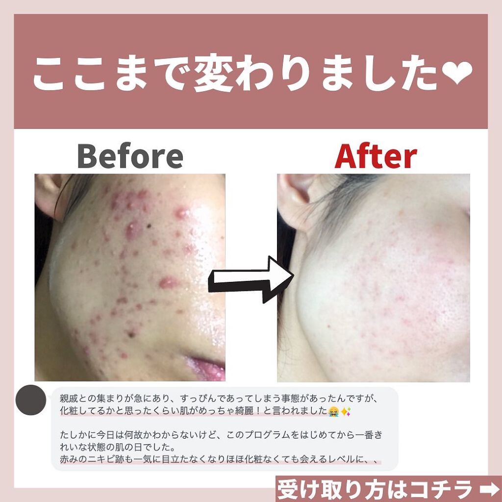 あなたの肌に合ったスキンケア💐コーくん先生 on LIPS 「あなたのスキンケアは大丈夫ですか?『よかった!!』『超タメにな..」(9枚目)
