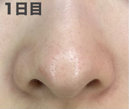 おうちdeエステ 肌をなめらかにするマッサージ洗顔ジェル 炭/ビオレ/その他洗顔料を使ったクチコミ(2枚目)