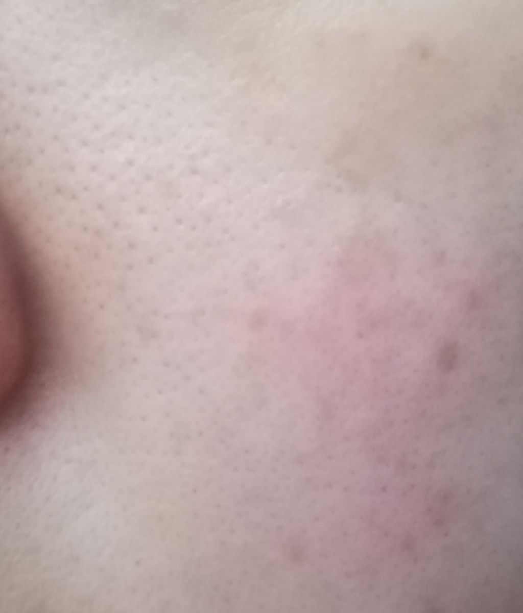 スターターキット(マット)/エトヴォス/トライアルキットを使ったクチコミ(2枚目)