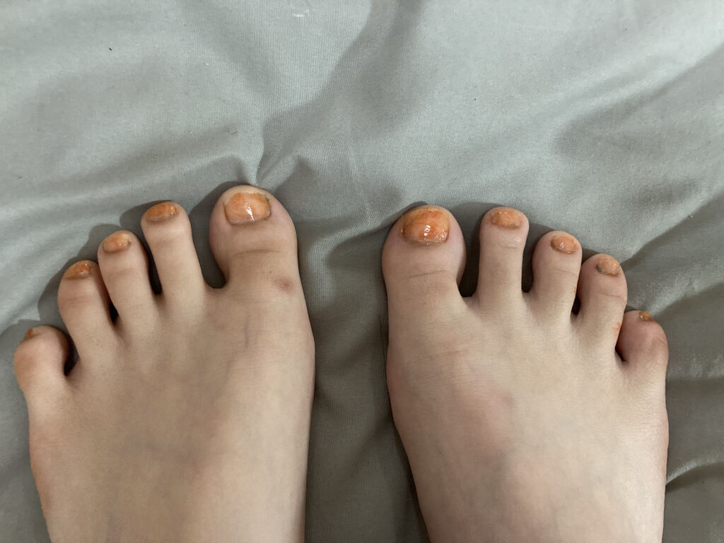 を使ったクチコミ（1枚目）