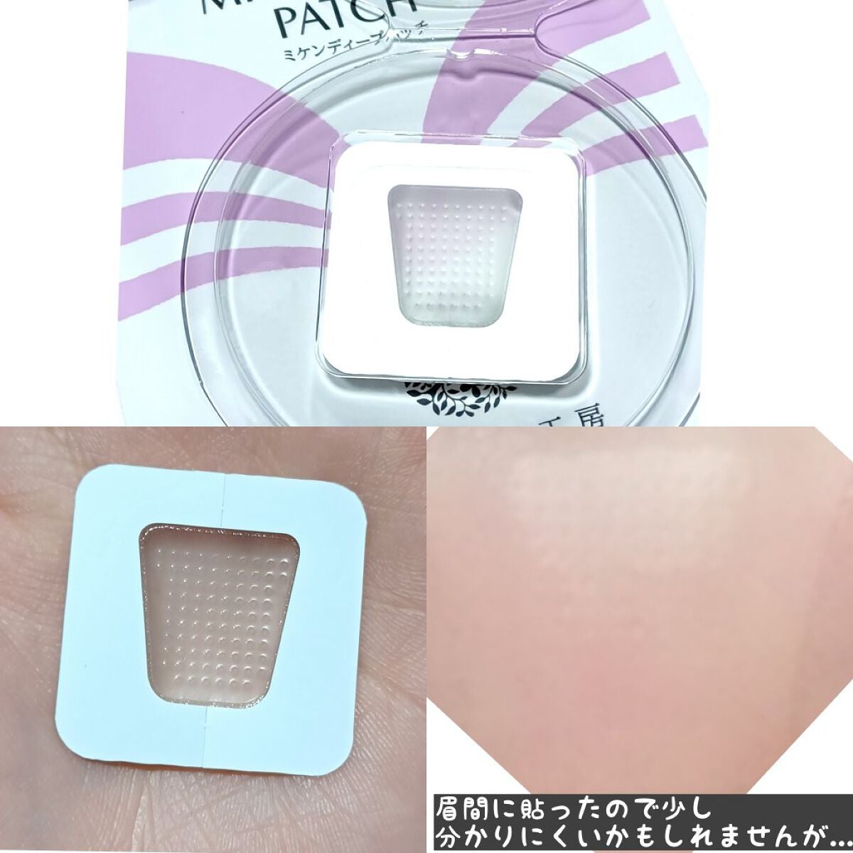 ミケンディープパッチ/北の快適工房/シートマスク・パックを使ったクチコミ(3枚目)