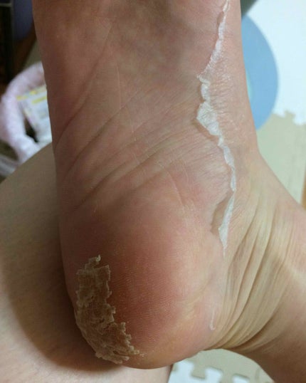 イージーパックDP60分タイプ/ベビーフット/レッグ・フットケアを使ったクチコミ(3枚目)