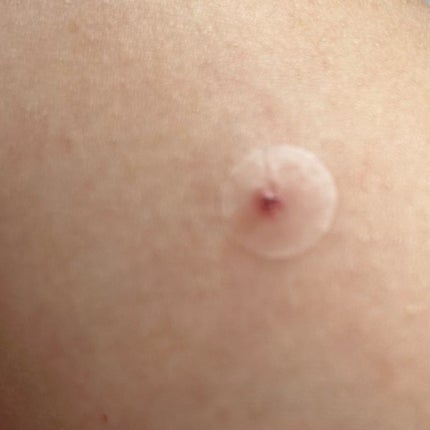 極薄透明パッチ nikipa!/金冠堂/にきびパッチを使ったクチコミ(3枚目)