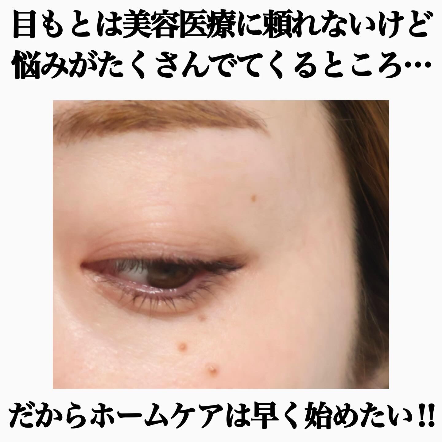 アイパーフェクトショットa/エピステーム/アイケア・アイクリームを使ったクチコミ（2枚目）