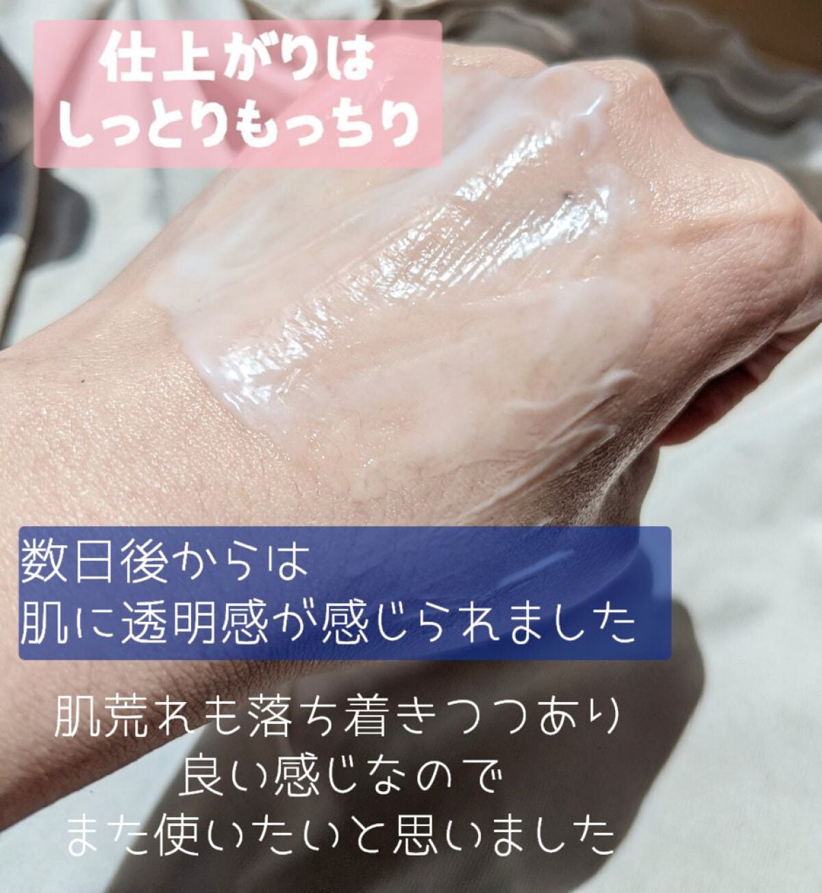 ãã©ã€ããã³ã°ã±ã¢ ããŒã·ã§ã³ MïŒå»è¬éšå€åïŒ/ã¢ã¯ã¢ã¬ãŒãã«/åç²§æ°Žã䜿ã£ãã¯ãã³ãïŒ8æç®ïŒ