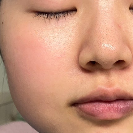 PDRNショット675/COSNORI/美容液を使ったクチコミ(3枚目)