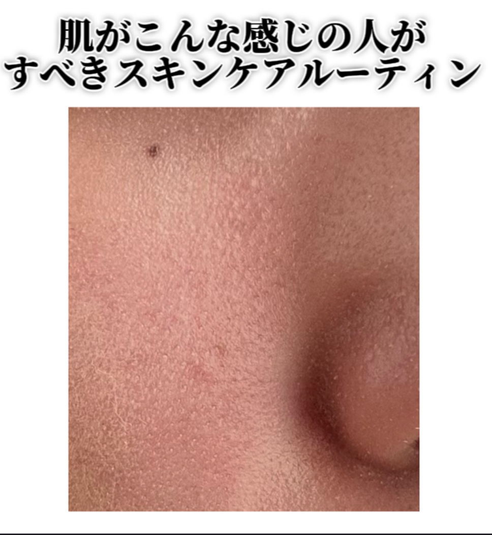 RMK Wトリートメントオイル/RMK/ブースター・導入液を使ったクチコミ（1枚目）