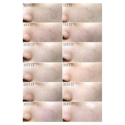 RF美顔器 ブライトリフト/YA-MAN TOKYO JAPAN/美顔器・マッサージを使ったクチコミ(6枚目)