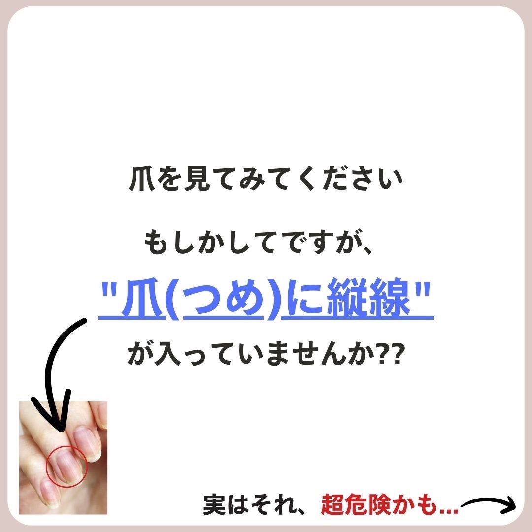 あなたの肌に合ったスキンケア💐コーくん先生 on LIPS 「【誰にも教えないでください】鼻の角栓たった3日で消す方法🤫....」(3枚目)