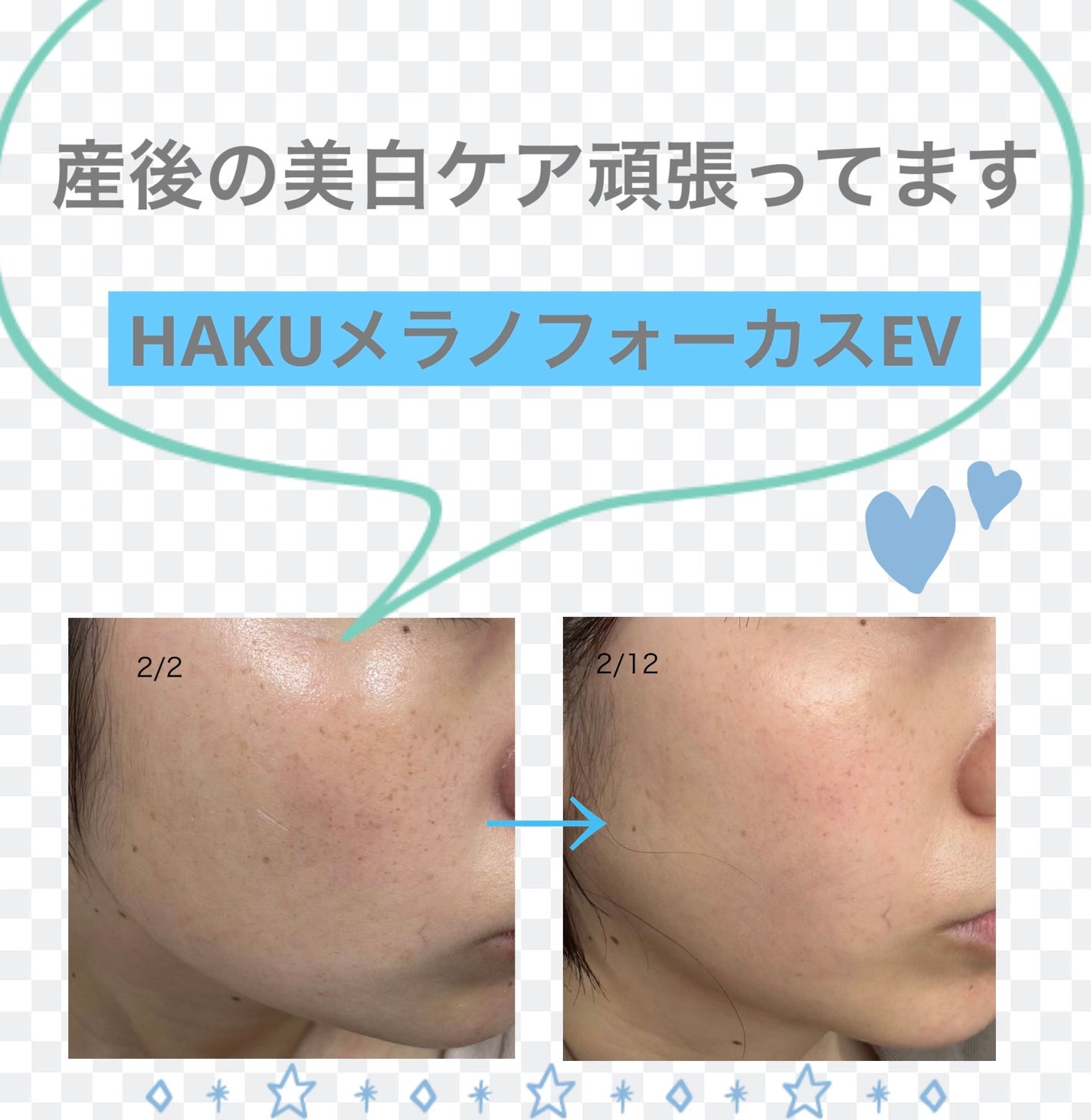 ディープクリア酵素洗顔 /メラノCC/洗顔フォームを使ったクチコミ(1枚目)