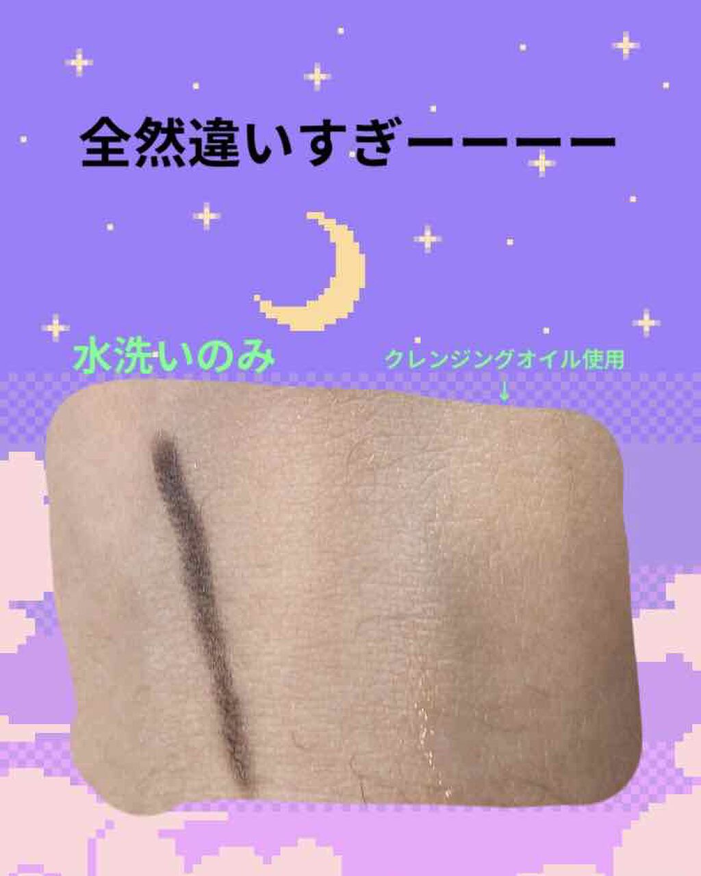 ソフティモ スピーディ クレンジングオイル/ソフティモ/オイルクレンジングを使ったクチコミ(2枚目)