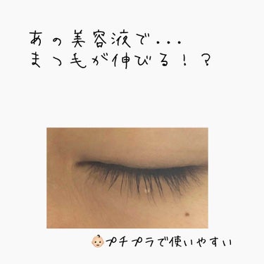 こんにちは🙌🏻


今回は私が実際に感じたまつ毛について
投稿させていただきます🙇🏻‍♀️


今年の5月の時まつ毛の短さに悩んでいて
常にまつ毛の伸びる方法を検索してました🤥

検索した上でお手軽なと