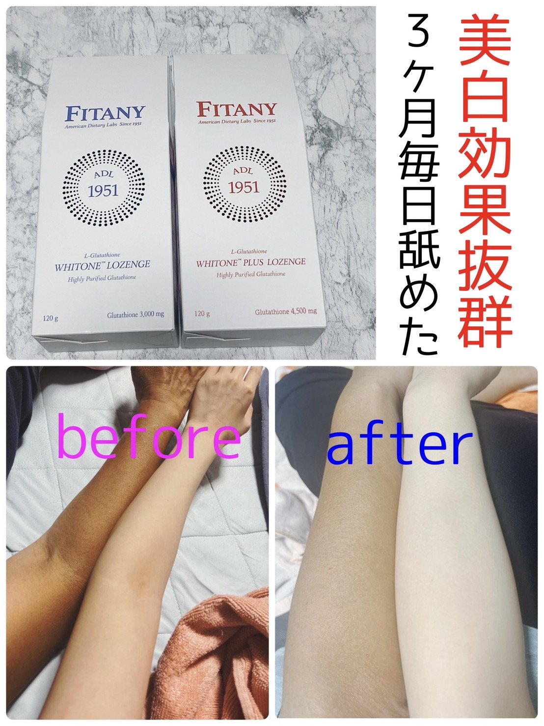 ホワイトーンプラスロゼンジ｜FITANYの効果に関する口コミ - 個