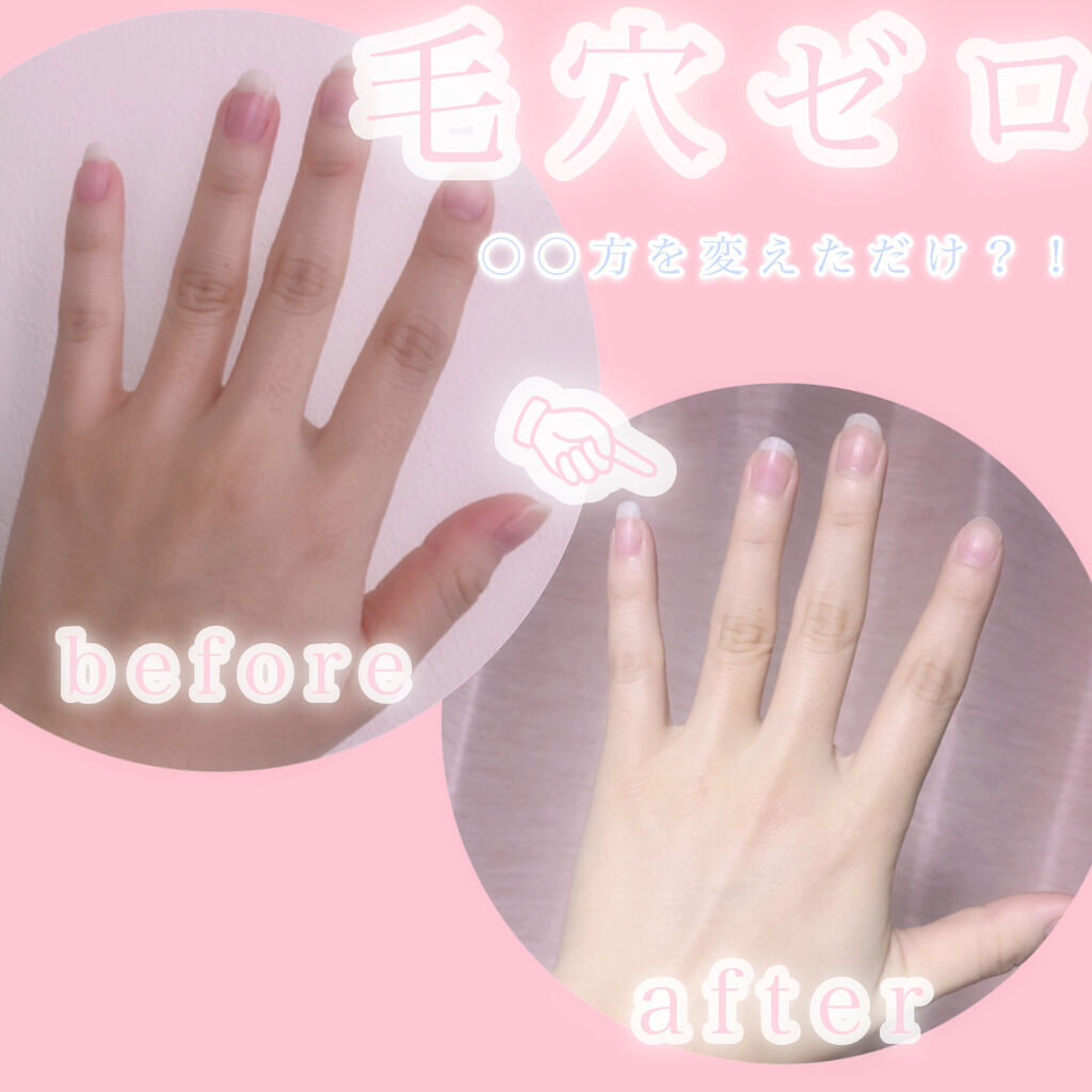 トーンアップ ハンドクリーム コエンリッチq10の口コミ 毛穴ゼロで手の女子力あげませんか By ねころびちゃん 脂性肌 代前半 Lips