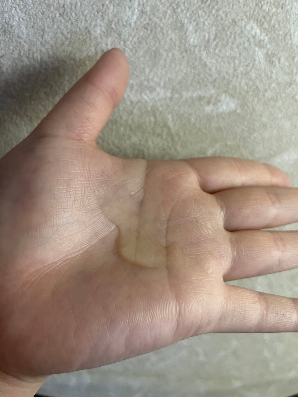 ビタペアC 集中美容液スペシャルセット/ネイチャーリパブリック/美容液を使ったクチコミ(2枚目)