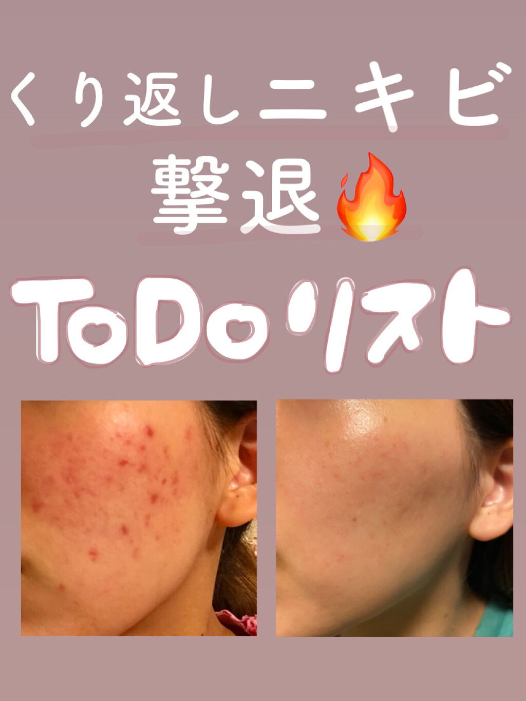 薬用美白ファンデーションSPF50+/ONLY MINERALS/ルースパウダーを使ったクチコミ（1枚目）