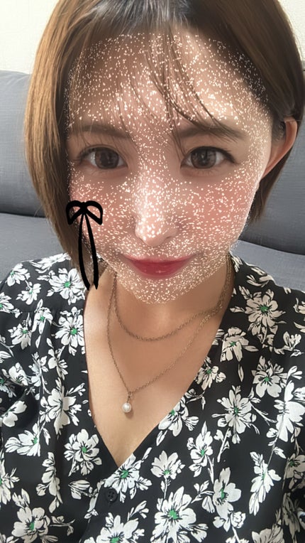 æ¡éŠð·LIPSããŒãããŒâ€ïžâð¥ on LIPS ãçŸå®¹èšé²ââªÂ·Í·âê³â€ïžâð¥hairäºæ
1幎4ã¶ææ¯ãã®çŸå®¹..ãïŒ8æç®ïŒ