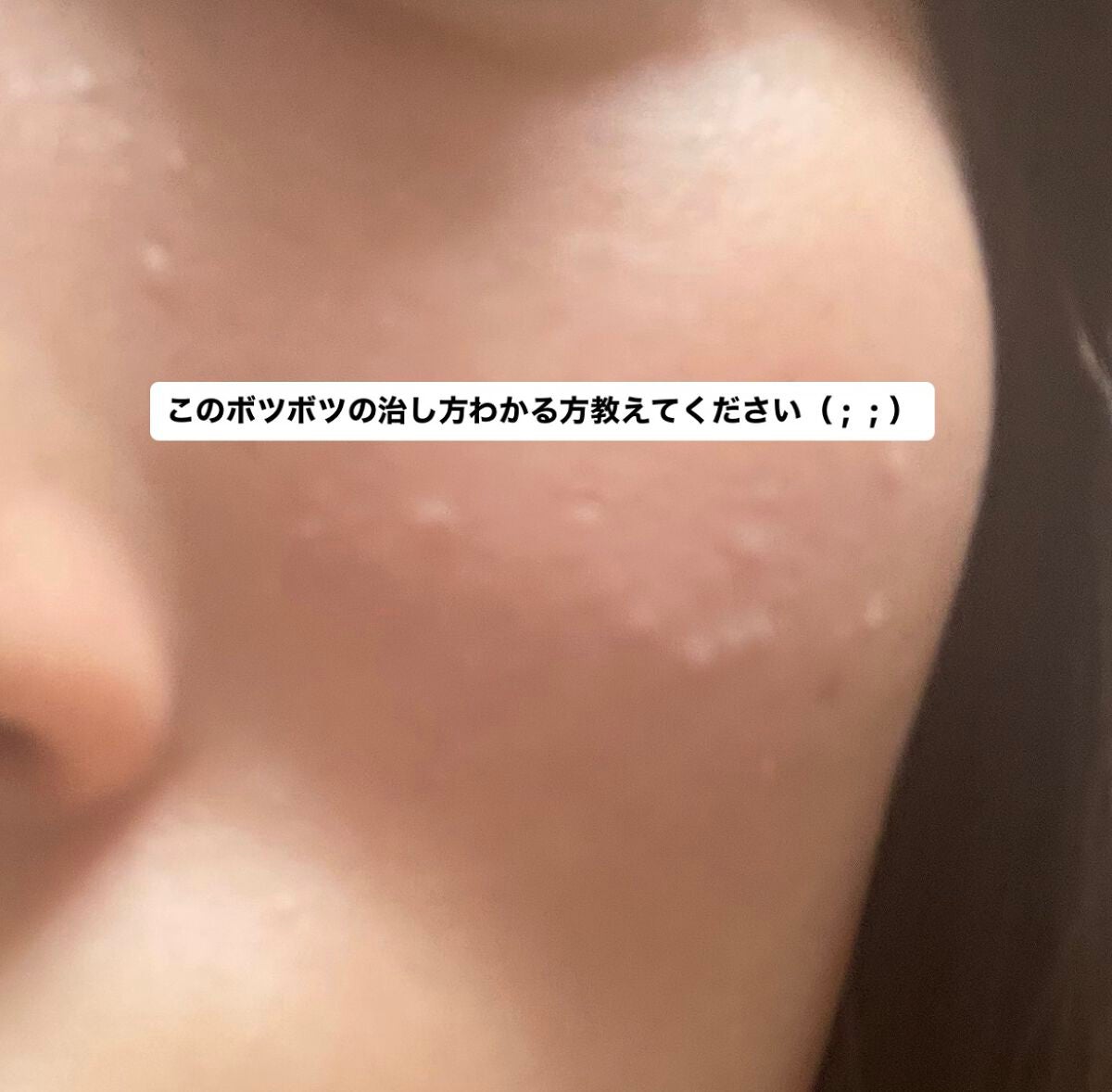 ðŒ ð ð ð ð ð€ on LIPS ãæè¿ã«ãªã£ãŠèã«ããããåãããªããããããåºãŠããŠããŸããŸã..ãïŒ1æç®ïŒ