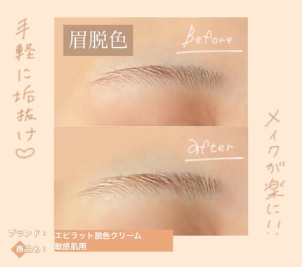 脱色クリーム 敏感肌用/エピラット/ムダ毛ケアを使ったクチコミ(1枚目)