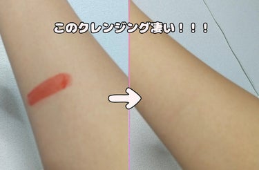 薬用泡のふんわり洗顔/スキンライフ/泡洗顔を使ったクチコミ（1枚目）