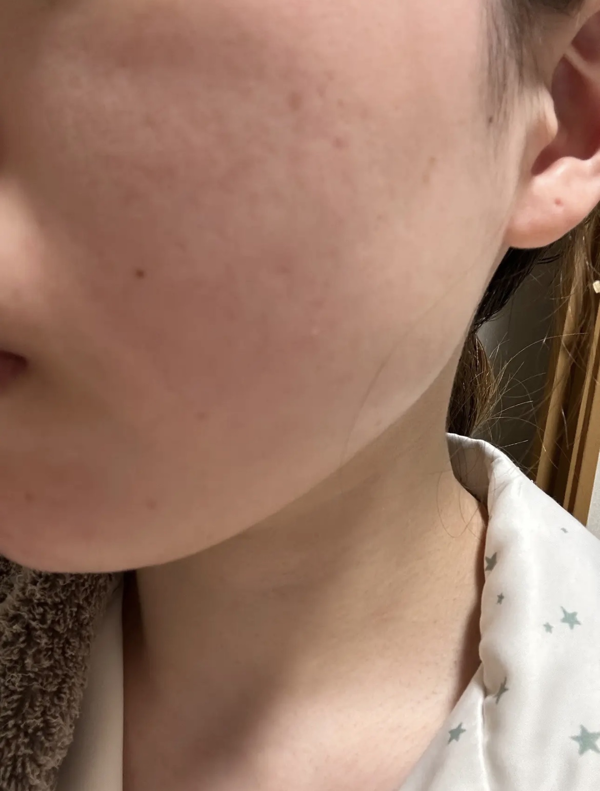 &honey クレンジングバーム モイスト/&honey/クレンジングバームを使ったクチコミ（3枚目）