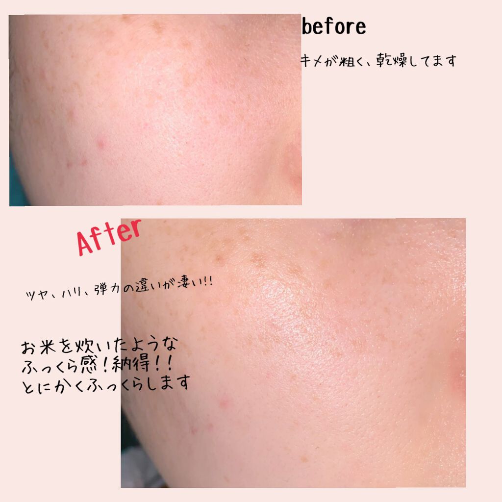 お米のマスク/毛穴撫子/シートマスク・パックを使ったクチコミ(3枚目)