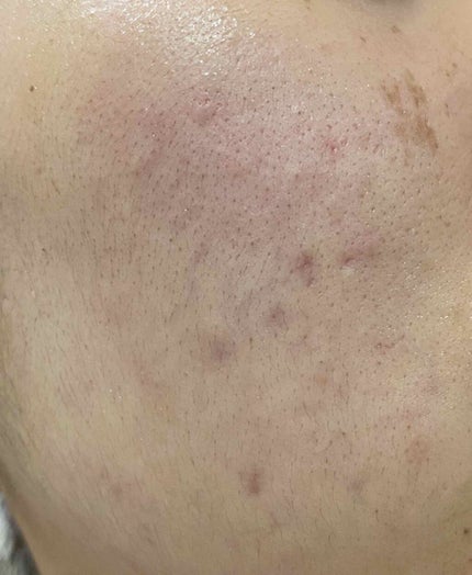 敏感肌用薬用美白美容液/無印良品/美容液を使ったクチコミ(2枚目)