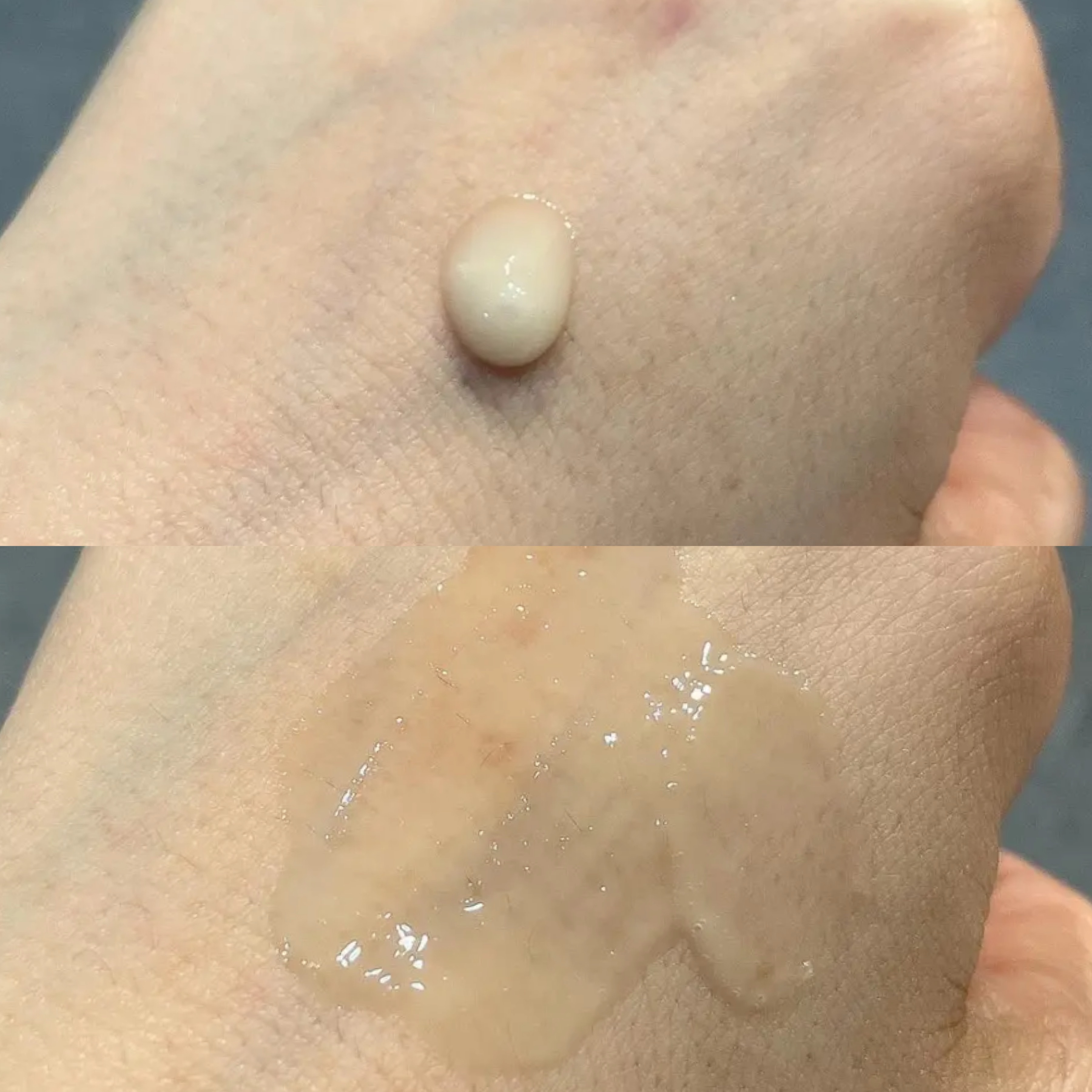 ブラックスネイル クリーム/Dr.G/フェイスクリームを使ったクチコミ（3枚目）