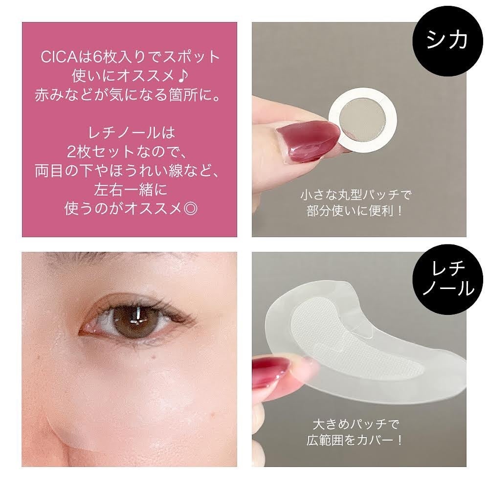 マイクロニードルパッチ シカ/MANYMU/シートマスク・パックを使ったクチコミ(3枚目)