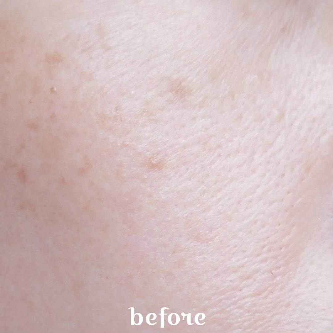 CICA デイリースージングマスク/VT/シートマスク・パックを使ったクチコミ(4枚目)